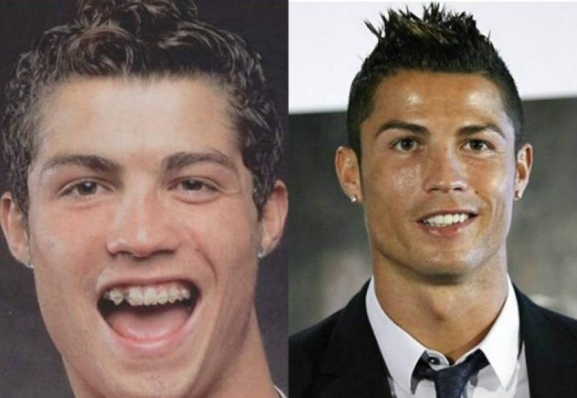 Cristiano Ronaldo se ha sometido a diversas cirugías.
