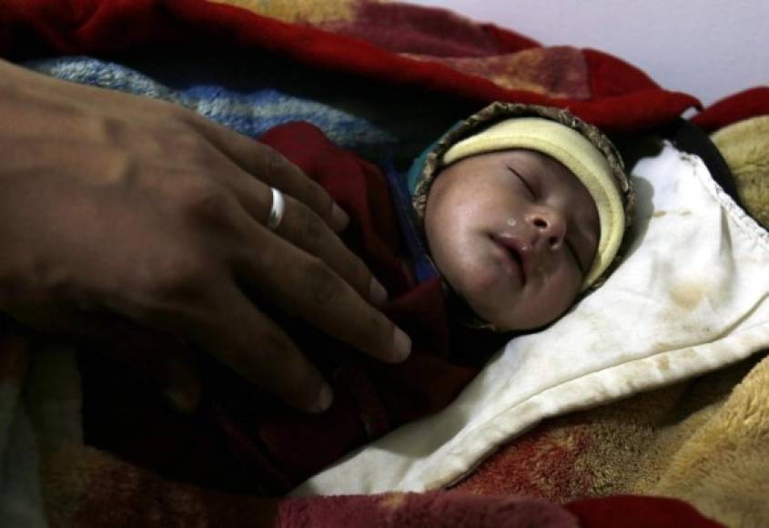 YEMEN. País atacado por el cólera. Una niña enferma de cólera recibe tratamiento en un hospital en Saná; según la ONU, hay 686,000 enfermos.