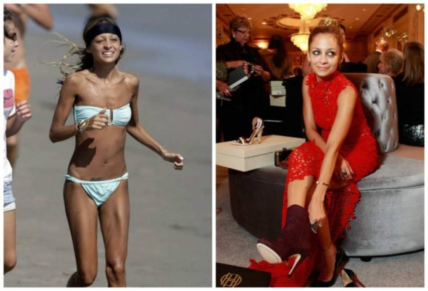 Nicole Richie. Pese a que nunca reconoció haber sufrido de un trastorno de la alimentación, dijo que 'un desorden alimenticio es una cosa seria y es una enfermedad'. Desde que es mamá, su alimentación parece haberse equilibrado, ya que se ve mucho más sana.