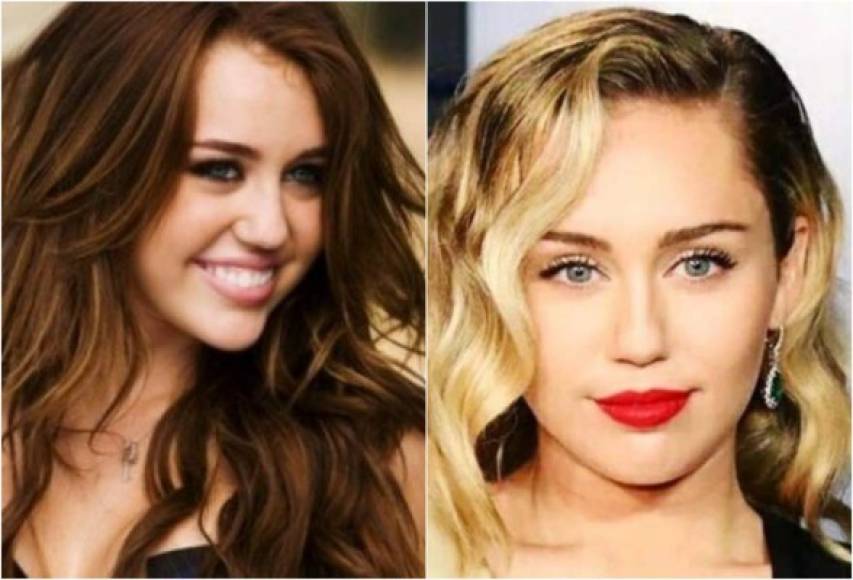 ¿Cirugía plástica?, así luce Miley Cyrus antes y después.