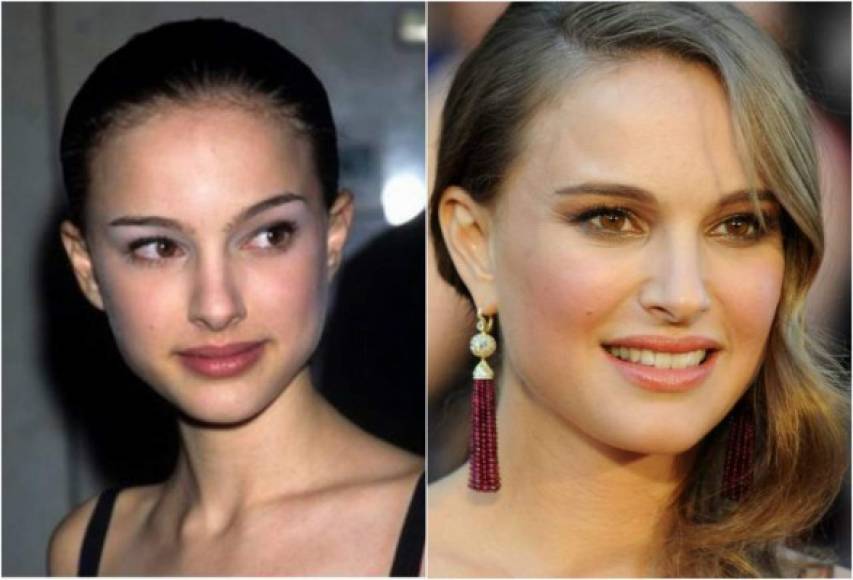 Natalie Portman también tuvo que usar el bisturí para lucir más bella. En las imágenes podemos ver el antes y después y su nariz está modificada.