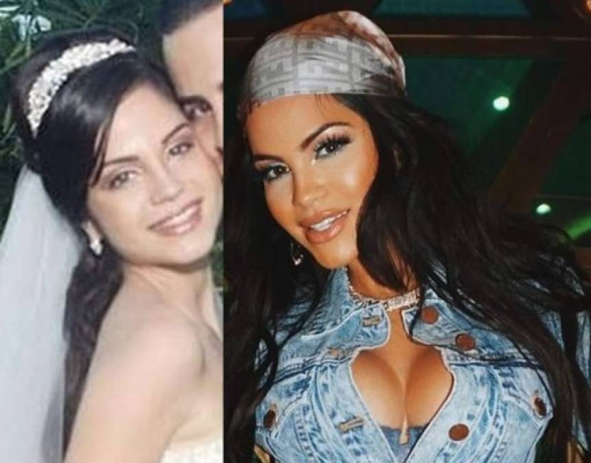 Algunos de los fans de la artista de 33 años resaltaron que Natti Natasha lucía mucho mejor antes, y señalaron que los labios que luce actualmente no le favorecen tanto.