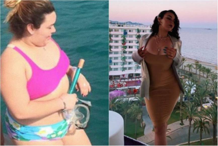 “Bajar de peso NO es fácil. La comida es una droga más”, declaró Jesaaleys mostrando una foto de su impactante antes y después.