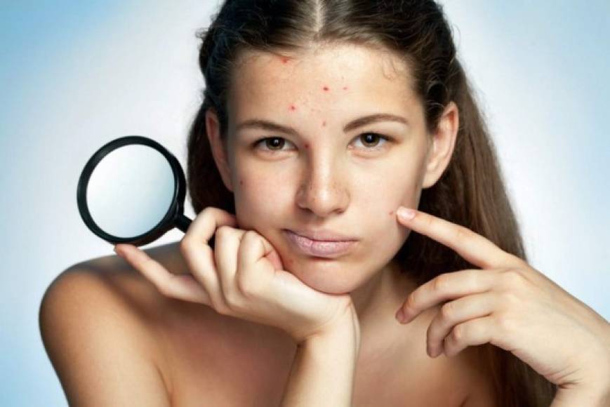 4. Para la piel grasa o combinada se puede usar limpiadoras con gránulos y hacer una exfoliación ligera. En pieles normales o maduras use una que tenga ácido glicólico o un ingrediente similar.