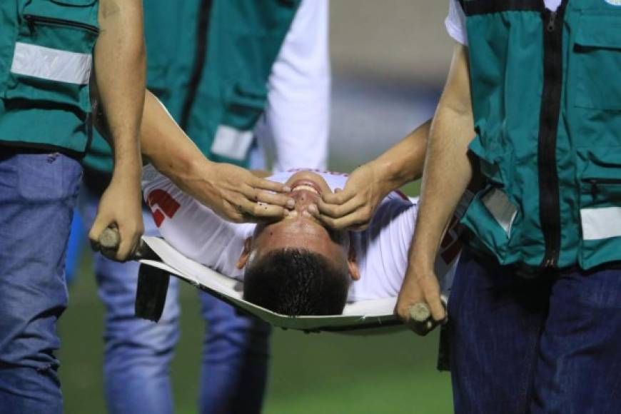 La mala noticia del partido UPN-Olimpia la dio Jonathan Paz, quien salió lesionado en camilla y con lágrimas de dolor. El defensa sufrió una contractura muscular.