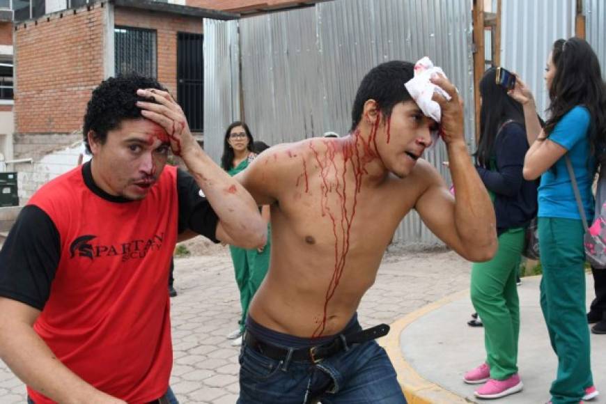 Uno de los estudiantes en protesta, con el rostro cubierto, dijo a periodistas que 'muchos compañeros están sangrando, otros con las piernas rotas por los golpes que han recibido con cadenas'.<br/>