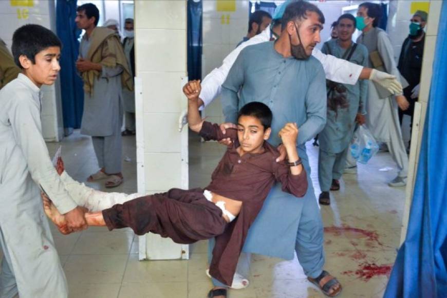 El hospital, que dispone de una importante maternidad, se encuentra en el oeste de Kabul, donde vive la minoría hazara, blanco a menudo de ataques de militantes del grupo Estado Islámico (Isis).