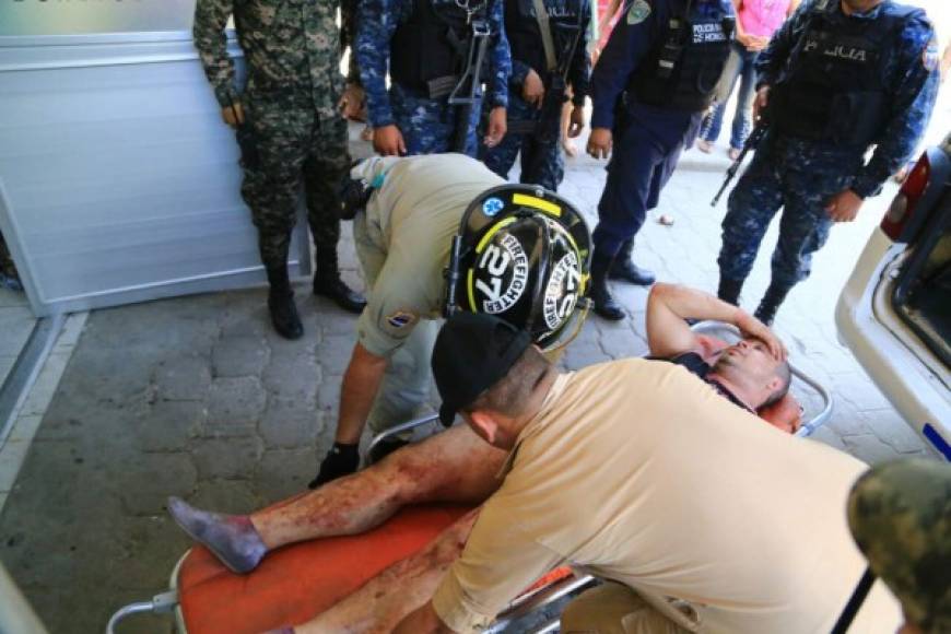 Los 33 reclusos que resultaron heridos fueron atendidos en el hospital Mario Rivas de San Pedro Sula.