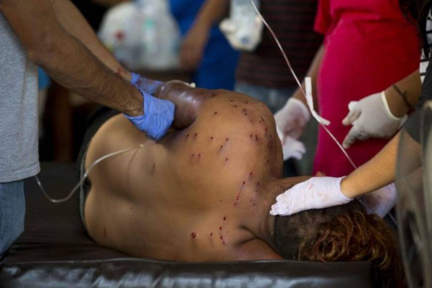 Personal médico voluntario y personal de la Cruz Roja atendieron a varios de los heridos, alcanzados por las armas de fuego, en plena calle.