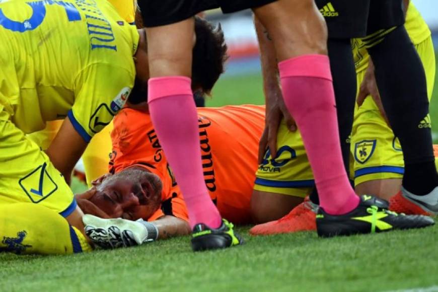 Los compañeros del portero del Chievo Verona acudieron rápidamente a asistirle.