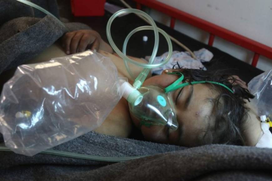 Las víctimas 'tienen las pupilas dilatadas, convulsiones, espuma saliéndole de la boca', explicó Hazem Shahwane, un socorrista entrevistado en uno de los hospitales de la ciudad. Al menos 11 niños fallecieron, según el Observatorio Sirio de Derechos Humanos (OSDH).