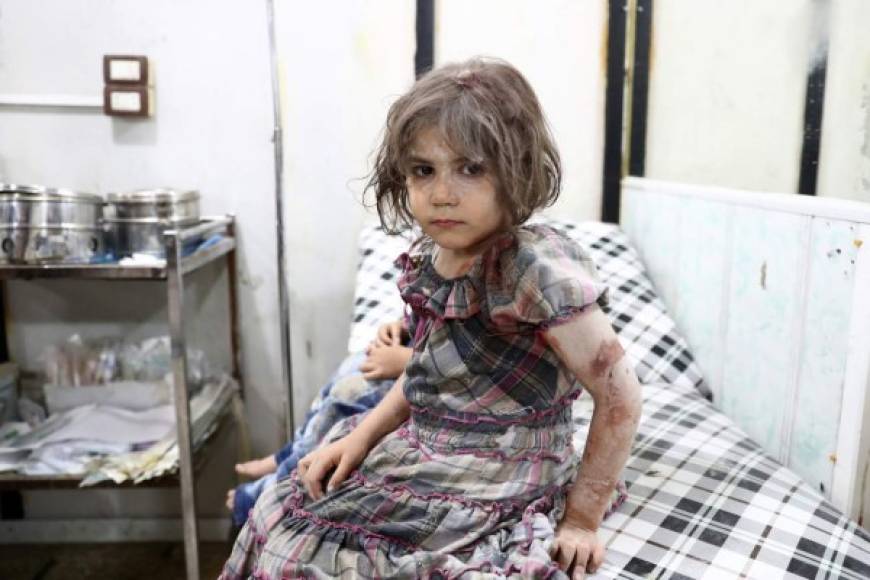 SIRIA. Las víctimas inocentes de la guerra. Una niña siria herida espera ser atendida en un hospital improvisado tras un ataque aéreo en la ciudad de Douma. Foto: AFP/ Abd Doumany