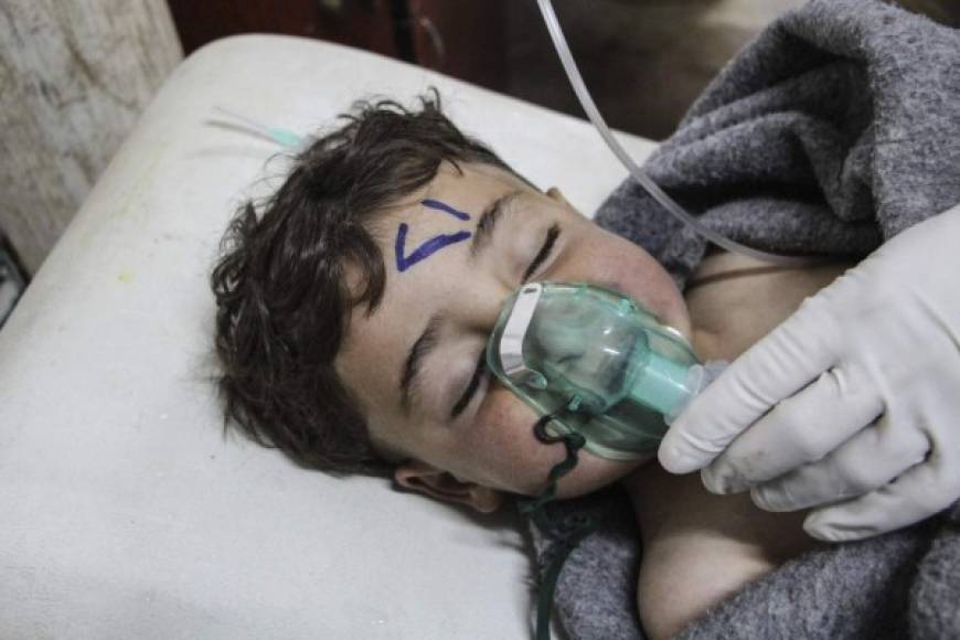 Un niño recibe tratamiento médico tras un supuesto ataque químico contra la localidad de Jan Shijún, en el sur de la provincia septentrional de Idleb, en Siria, hoy, 4 de abril de 2017.