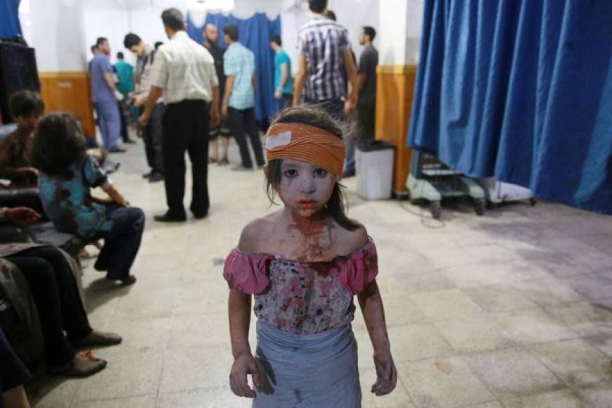 La imagen de una niña herida en un hospital de Douma, Siria, fue catalogada como una de las mejores por el World Press, fue tomada por Abd Doumany.