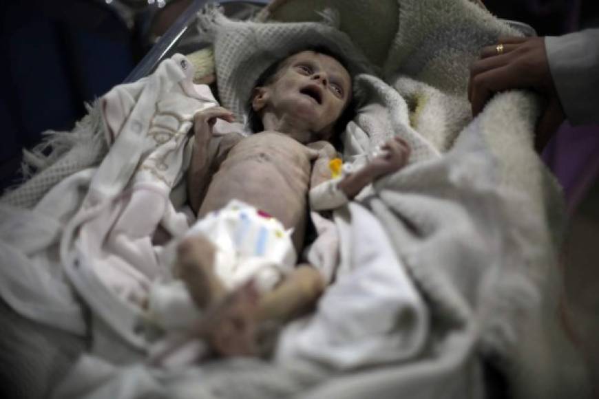 El sábado, los padres de la pequeña Sahar Dofdaa llevaron a su hija de 34 días a un hospital de Hamouria, una localidad de la Guta, según una imágenes grabadas por un colaborador de la AFP.<br/><br/>