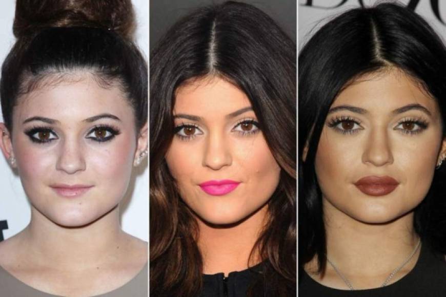Kylie también siguió los pasos de sus famosas hermanas transformando su imagen gracias a los procedimientos quirúrgicos de belleza.