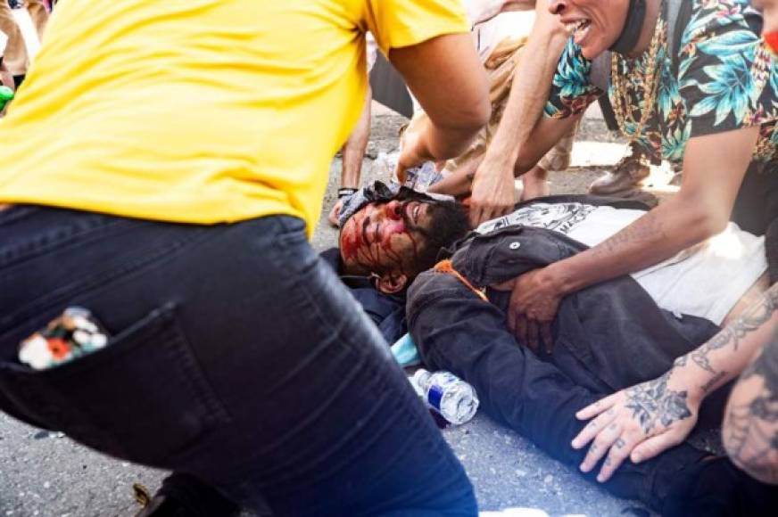 Los violentos enfrentamientos entre policías y manifestantes dejaron varios heridos.