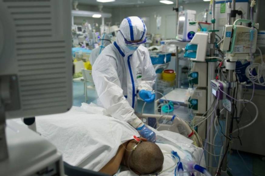 This photo taken on February 22, 2020 shows a nurse checking a patient in an intensive care unit treating COVID-19 coronavirus patients at a hospital in Wuhan, in China's central Hubei province. - China on February 26 reported 52 new coronavirus deaths, the lowest figure in more than three weeks, bringing the death toll to 2,715. (Photo by STR / AFP) / China OUT