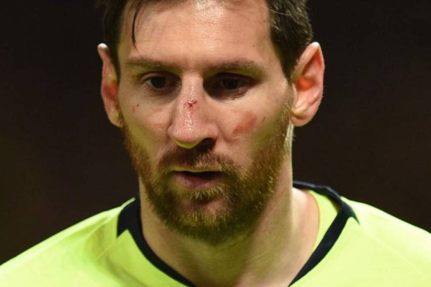 Así le quedó la cara a Messi tras el golpe.
