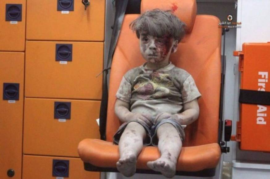 Imágenes como la del pequeño Omran, han permitido al mundo sensibilizarse con el conflicto en Siria.