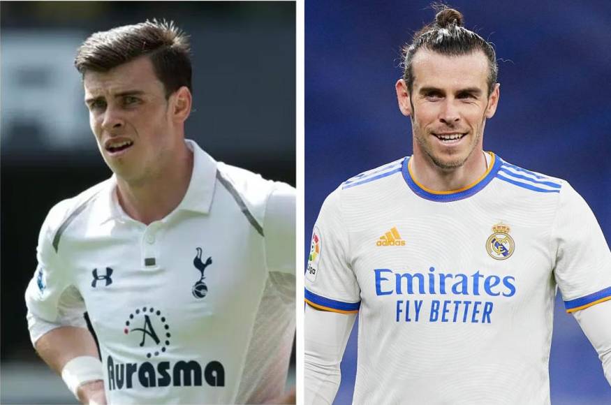 Gareth Bale - El exjugador galés, que jugó en Real Madrid y Tottenham, no es uno de los casos más llamativos, pero también se pueden apreciar grandes diferencias en su salud bucodental desde sus inicios en la Premier League hasta su llegada a la Liga Española.
