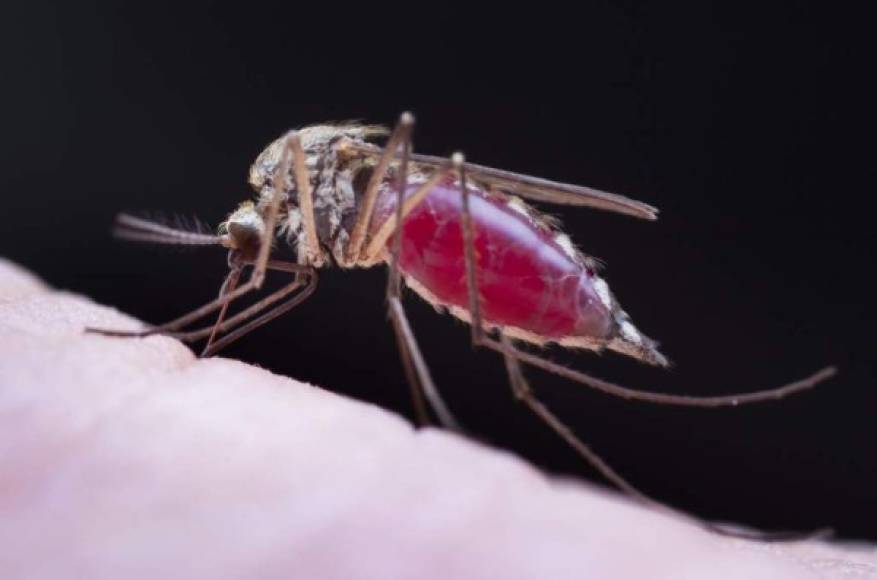 A baby infected with dengue, which vector is the Aedes aegypti, is assisted in the Roberto Suazo Cordova Hospital, in La Paz municipality, La Paz department, Honduras, on July 24, 2019. - The massive influx of people infected with dengue have collapsed 26 public hospital in Honduras in what the health authorities describe as the worst emergency of the last 50 years for this virus, which so far left 54 dead, mostly children, of the more than 28,000 patients. (Photo by ORLANDO SIERRA / AFP)