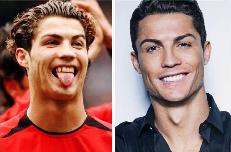 Cristiano Ronaldo - El futbolista portugués, en sus primeros años en el Manchester United, tenía un aspecto en los dientes muy lejos de la perfección que ha buscado en los últimos años tanto en su fútbol como en su cuerpo.