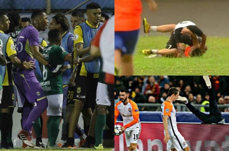 La violencia en el fútbol también está en los jugadores. El pasado sábado el arquero Denovan Torres del Marathón agredió a un recogepelotas en el derbi ante Real España. Hoy repasamos las ocasiones en que los jugadores han agredido a los chicos encargados de pasar la pelota, en Honduras no es la primera vez.