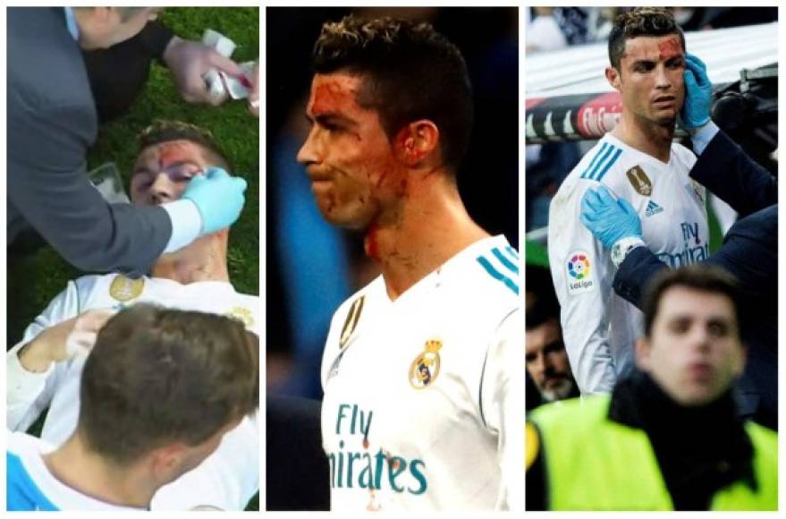 Además de la goleada de 7- al Deportivo con doblete de Cristiano, el crack luso dejó una nota curiosa luego de haber recibido un terrible golpe en su rostro y llegó al extremo de usar hasta un celular para verse.