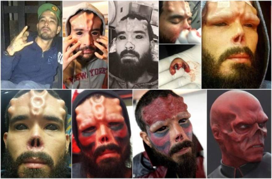 Este chico venezolano se llama Henry Damos y se ha hecho modificaciones corporales para parecerse al villano de Marvel, 'Red Skull'. Se ha cortado la nariz, tiene implantes en la frente y cejas, se ha hecho tatuajes rojos en la cara y en varias partes de su cuerpo.