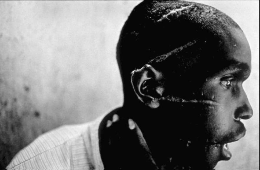 Premio World Press Photo 1994. El fotógrafo estadounidense James Nachtwey, obtuvo el galardón con su imagen 'Hutu mutilado', que refleja la crueldad de la guerra civil en Ruanda a principios de los noventa en la que murieron miles de personas.