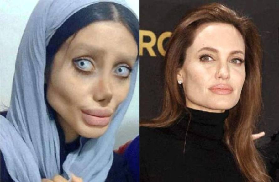 La iraní Sahar Taabar se alzó a la fama mundial cuando se viralizó su cuenta de Instagram, donde ha subido fotografías en las que mostraba la supuesta transformación de su rostro tras unas 50 cirugías que debía haberse realizado con un solo objetivo: parecerse a la famosa actiz Angelina Jolie.