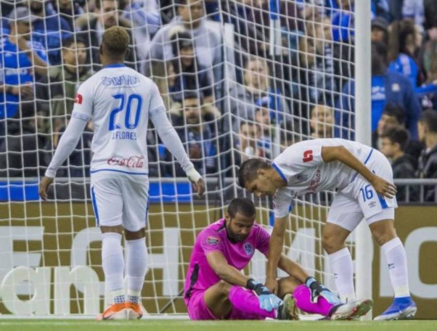 El partido no comenzó nada bien en el Olimpia ya que perdió por lesión a su portero titular Edrick Menjívar. El cancerbero salió cabizbajo y fue consolado por sus compañeros. Foto Cristian de Marchena/MEXSPORT