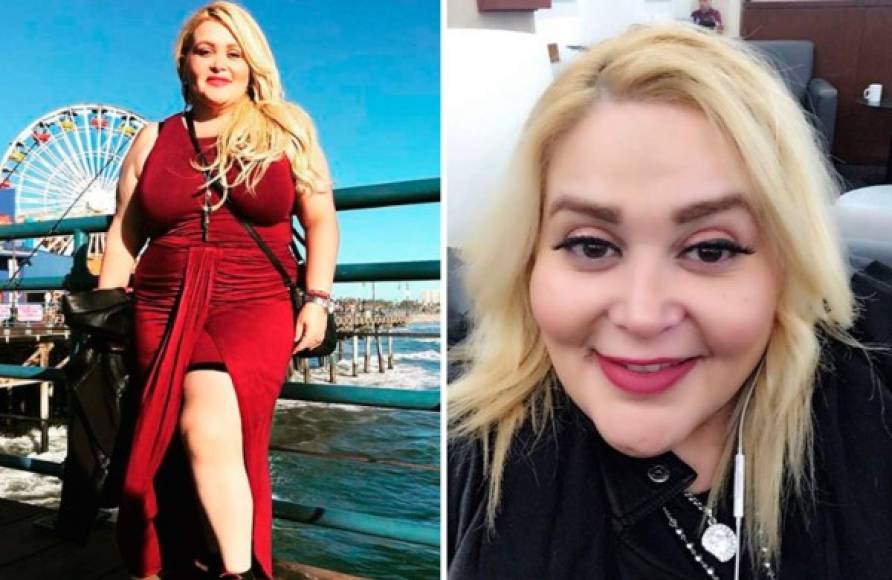 La famosa cantante y actriz 'Sheyla' es una de las celebridades más queridas en México. La rubia siempre ha sido honesta en cuanto a su lucha por bajar de peso, y es que en los últimos meses ha ganado un par de libras.