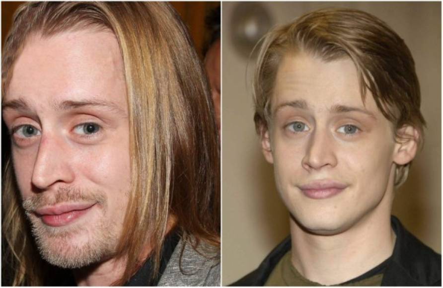 Cómo han pasado los años... El actor Macaulay Culkin está envejeciendo más rápido de lo normal. El pasado 26 de agosto cumplió 35 años pero su apariencia sigue tan descuidada. Lejos quedó la apariencia de aquel niño simpático y guapo que alcanzó el éxito con la saga 'Mi pobre angelito'. Vea su impactante transformación en estos años.