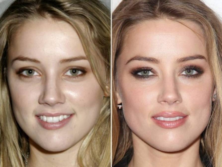 Amber Heard ocupó el tercer lugar con un 91.85 por ciento. Con el tiempo la ex de Johnny Depp ha conseguido afinar su nariz, reducir sus mejillas y aumentar sus labios, ¿gracias a las dietas?.