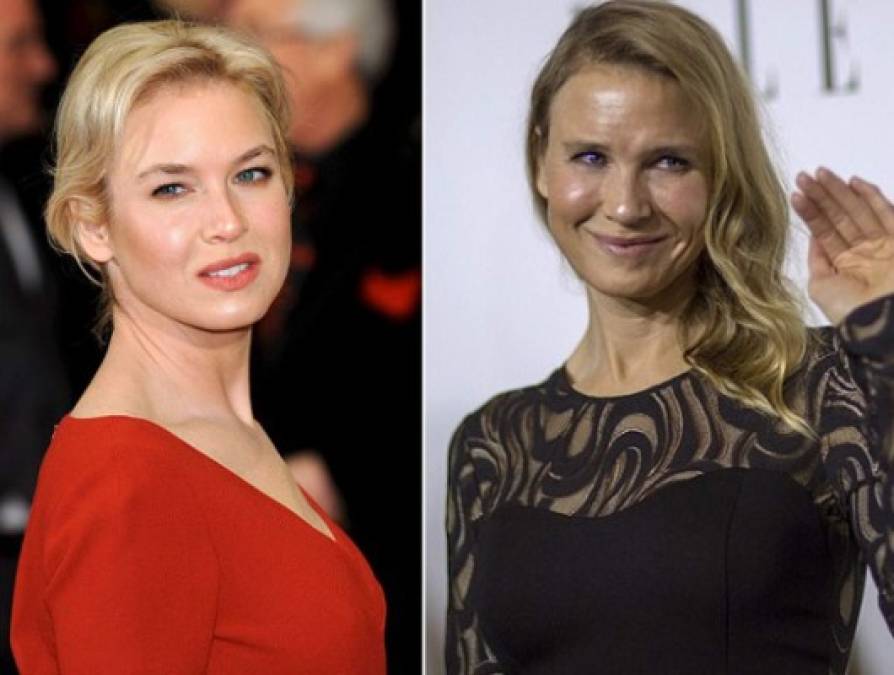 Renée Zellweger: El cambio en el rostro de la actriz es más que evidente. Se sometió a una blefaroplastia superior para retirar el exceso de piel en los párpados superiores, además se operó los labios y se hizo otras cirugías menores.<br/>