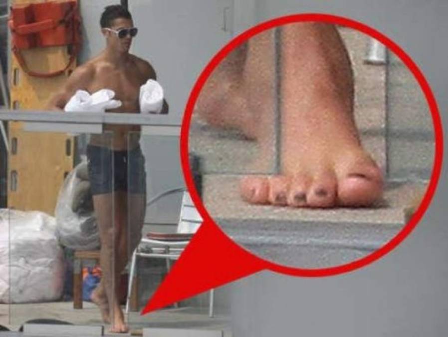 Cristiano Ronaldo tiene la costumbre de pintarse las uñas de los pies, que no son nada agradables.