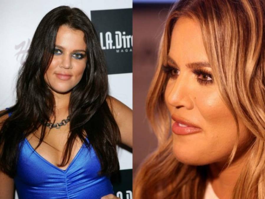 Khloé Kardashian en una foto comparativa cuando tenía 23 años y hoy a sus 31.