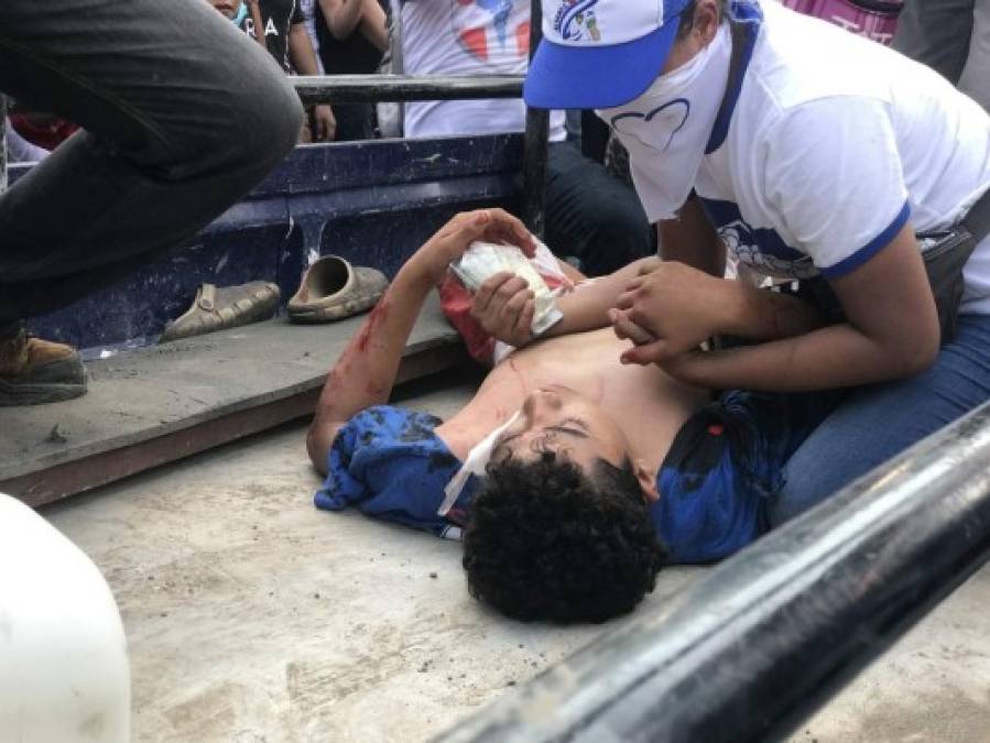 Nicaragua sigue sumida en el caos luego de que al menos 1 personas murieran y otras 79 resultaran heridas en los ataques ocurridos entre ayer y hoy en el marco de manifestaciones a favor y en contra del Gobierno de Daniel Ortega, informó este jueves el Centro Nicaragüense de Derechos Humanos (Cenidh). Foto: Twitter Wilfredo Miranda.