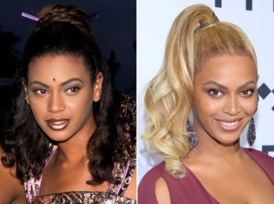 Beyoncé está en segundo lugar con un 92.44 por ciento. Sin embargo, Queen B tampoco se escapa de las especulaciones sobre retoques estéticos, llama la atención como su nariz se ido afinando con el tiempo.<br/>