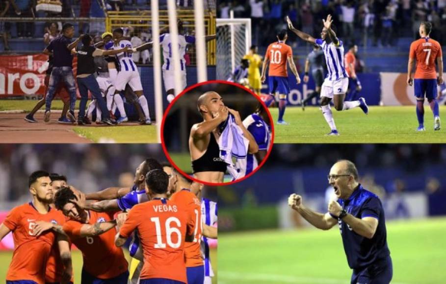 Las imágenes que dejó el partido amistoso que ganó Honduras (2-1) contra Chile en el estadio Olímpico.