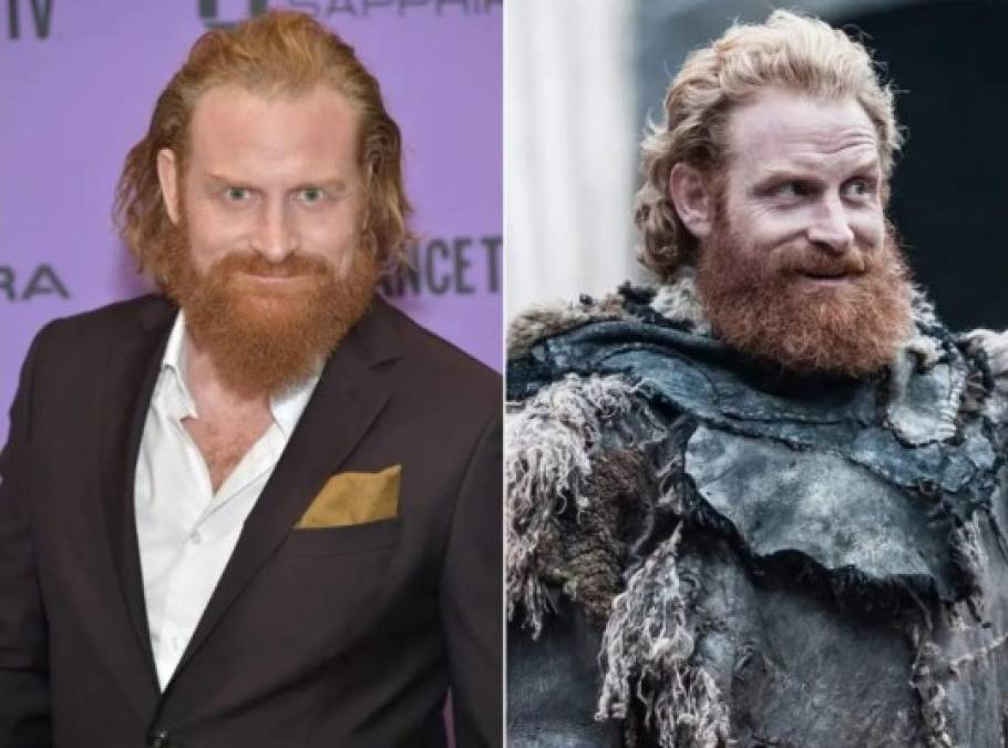 Kristofer Hivju<br/><br/>El actor noruego, famoso por shows como “Game Of Thrones” y “The Witcher”, confirmó en Instagram que tiene coronavirus. 'Hay personas con mayor riesgo para quienes este virus puede tener un diagnóstico devastador, por lo que les exhorto a que sean extremadamente cuidadosos; lávense las manos, manténgase a 1,5 metros de distancia de los demás, sigan en cuarentena; simplemente hagan todo lo posible para detener la propagación del virus', pidió Hivju.<br/>