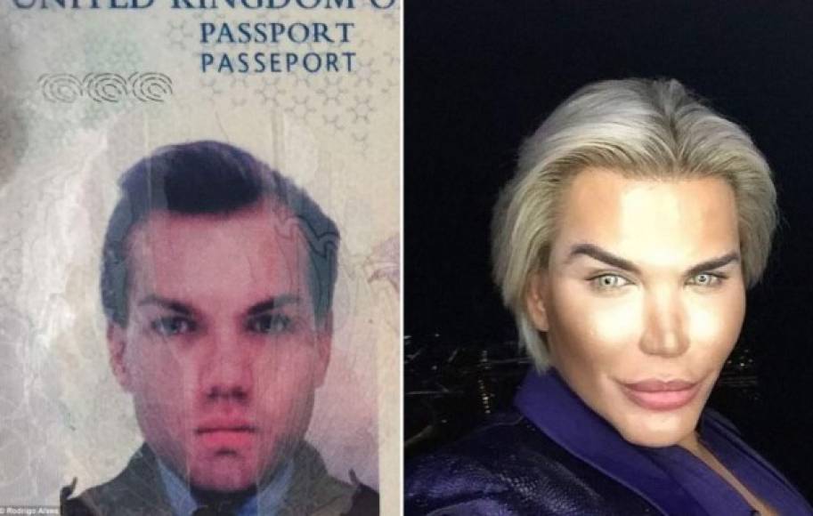 Rodrigo Alves explicó que recibió tratamiento psicológico antes de decidir hacer transición de hombre a mujer. 'Mi familia no estaba muy sorprendida. Soy tan afortunada y bendecida de tener una familia, amigos y personas que me apoyan y cuidan de mí.', dijo la Barbie trans.