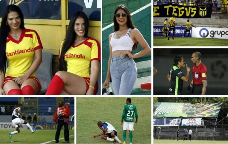 Una resumen de las imágenes que no viste en la televisón de la novena jornada del Torneo Apertura 2018 de la Liga Nacional de Honduras.