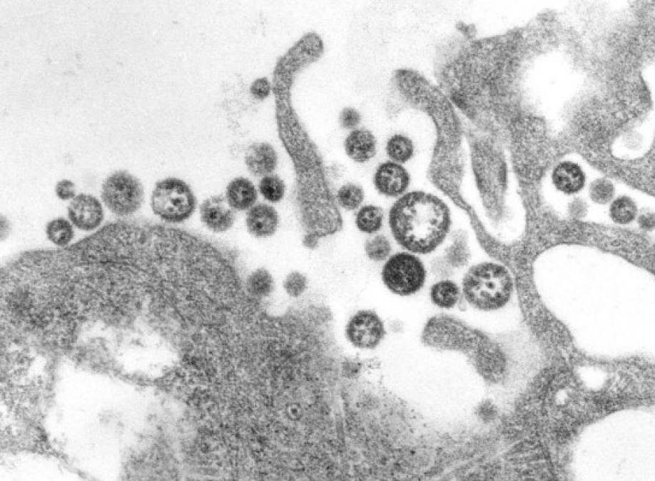 Fiebre de Lassa - El primer caso reportado de infección en humanos fue el de una enfermera nigeriana y fue descubierto en 1950, sin embargo, el virus se logró aislar hasta 1969.<br/><br/>La enfermedad es endémica de roedores de África Occidental, por ende los países más afectados son Guinea, Liberia y Sierra Leona, el contagio se da por el contacto directo con enseres domésticos contaminados por excremento de ratón de Benin.