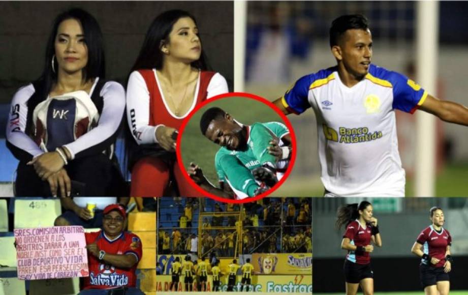 Las imágenes que no viste en televisión de los partidos del miércoles en la jornada 10 del Torneo Clausura 2019 de la Liga Nacional de Honduras.
