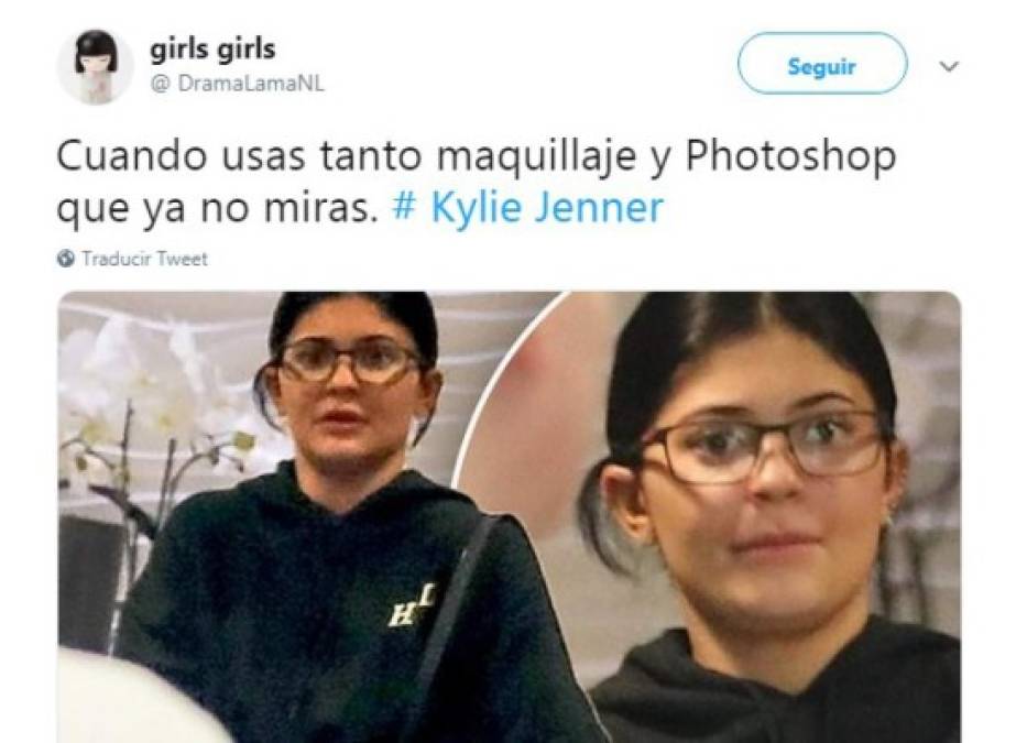 Aunque no es ningún secreto que Kylie Jenner se somete a tratamientos estéticos para dotar a sus labios de un mayor volumen, verla sin las infiltraciones que la han dado su sello característico dejó a los internautas anonadados. <br/>