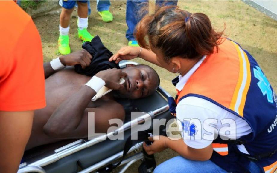Rubilio Castillo sufrió una fractura del arco cigomático de su pómulo derecho durante el partido ante Real de Minas y tuvo que ser operado de emergencia. Estará dos semanas de baja.