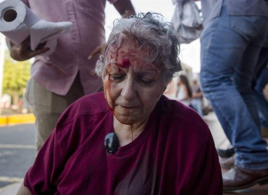 Los pensionados, que figuran entre los más afectados por las reformas, también salieron a protestar, en algunos casos, con lamentables consecuencias.